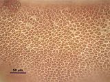 3 – Cellule corticali in visione superficiale